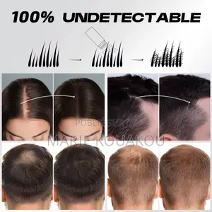 Fibre Capillaire