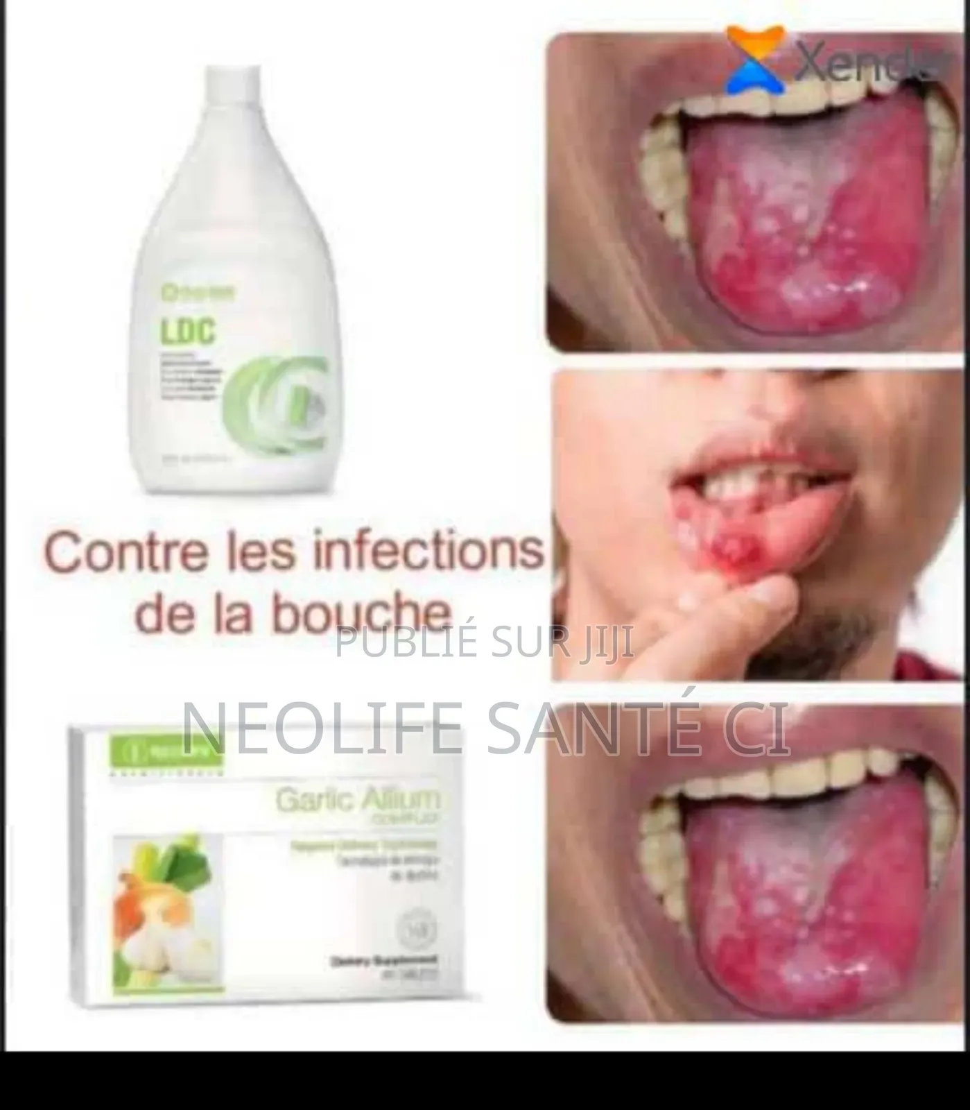 Contre Les Infections De La Bouche
