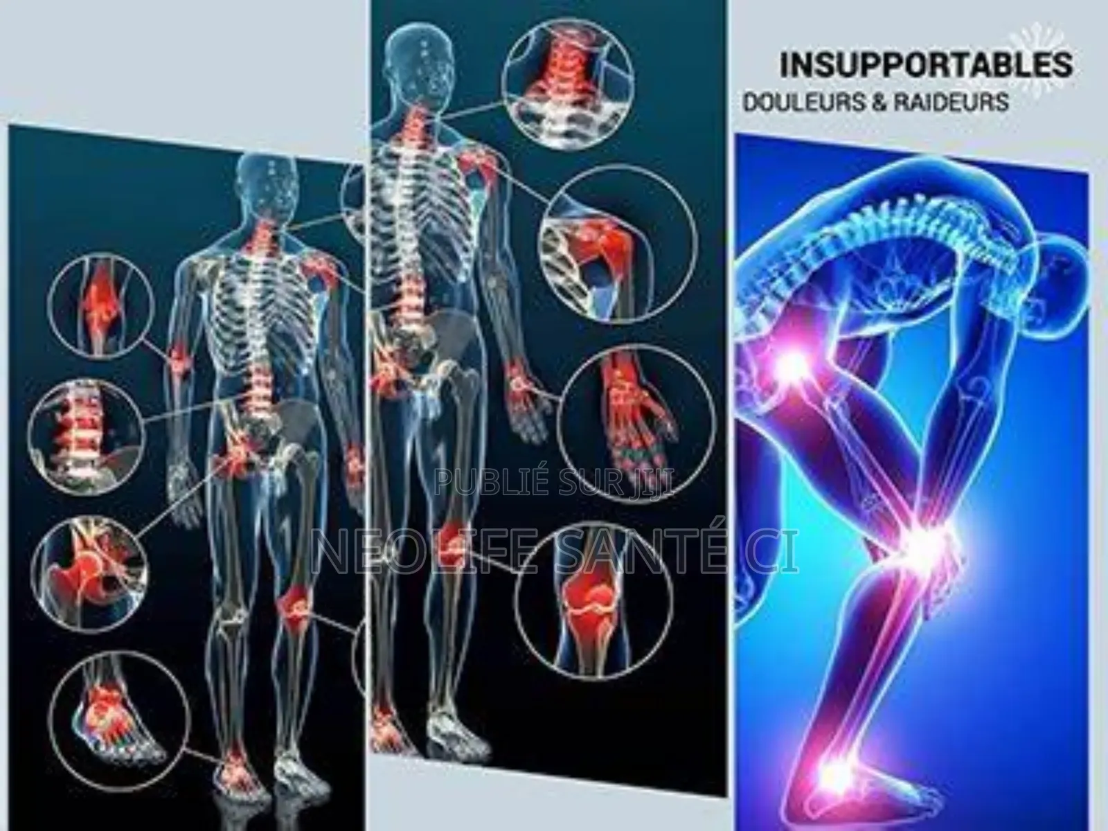 Produits Pour Les Articulations
