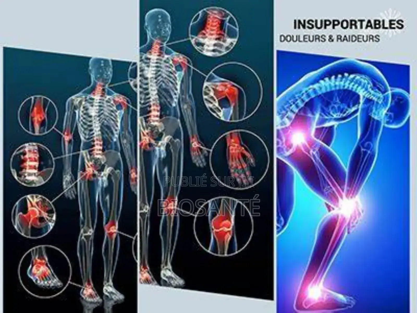 Produits Pour Les Articulations