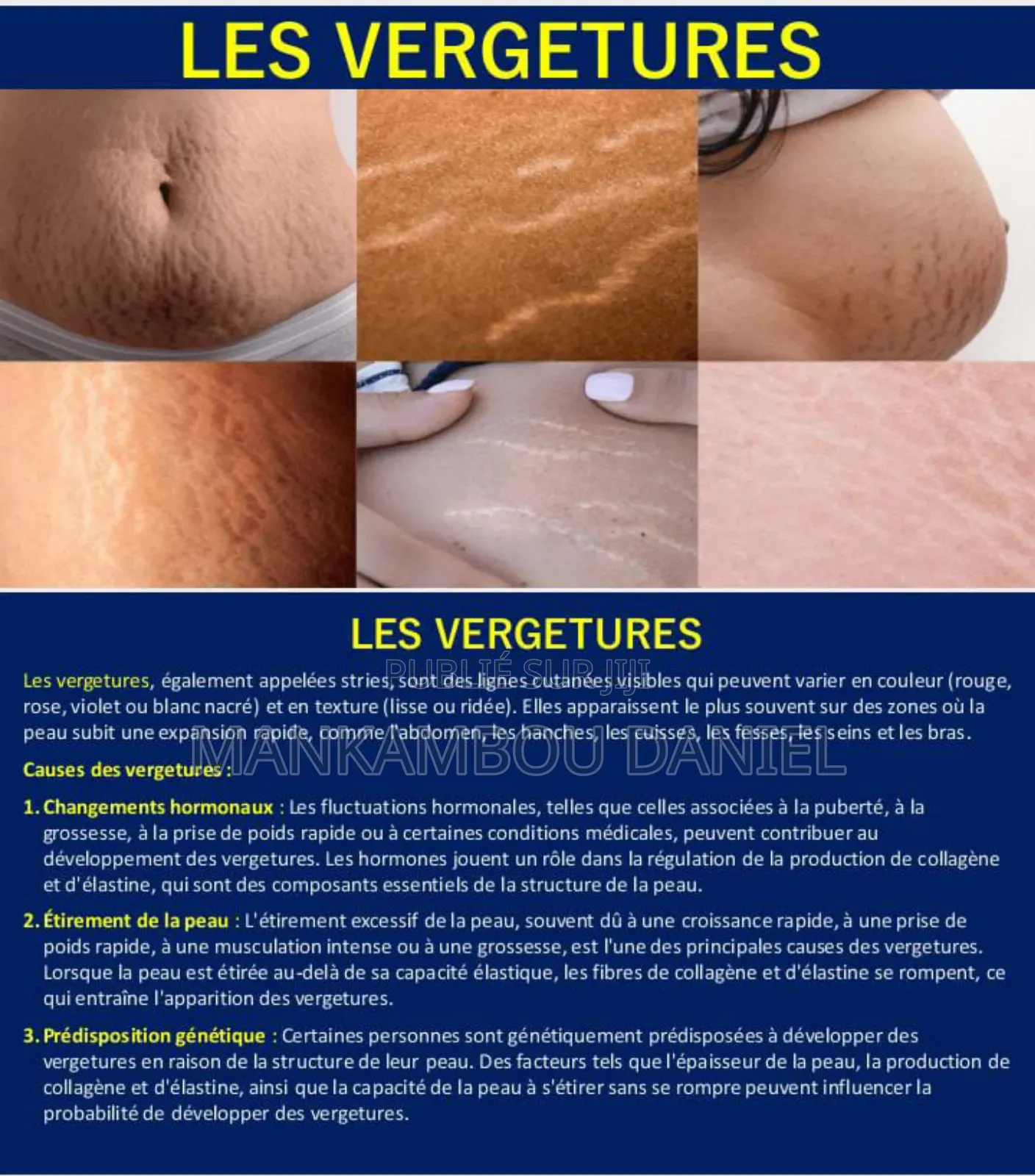 Savon Noir De Royal Cosmetik