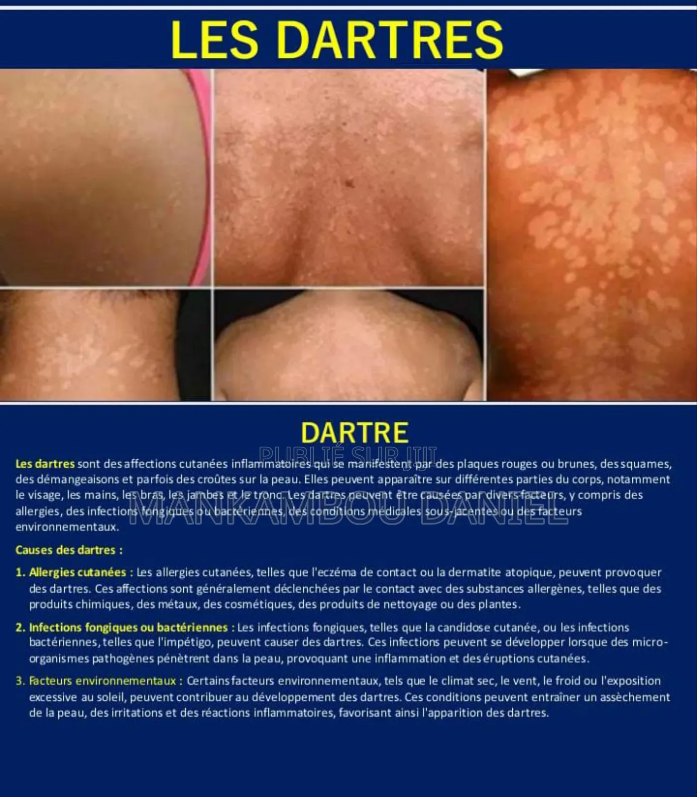 Savon Noir De Royal Cosmetik