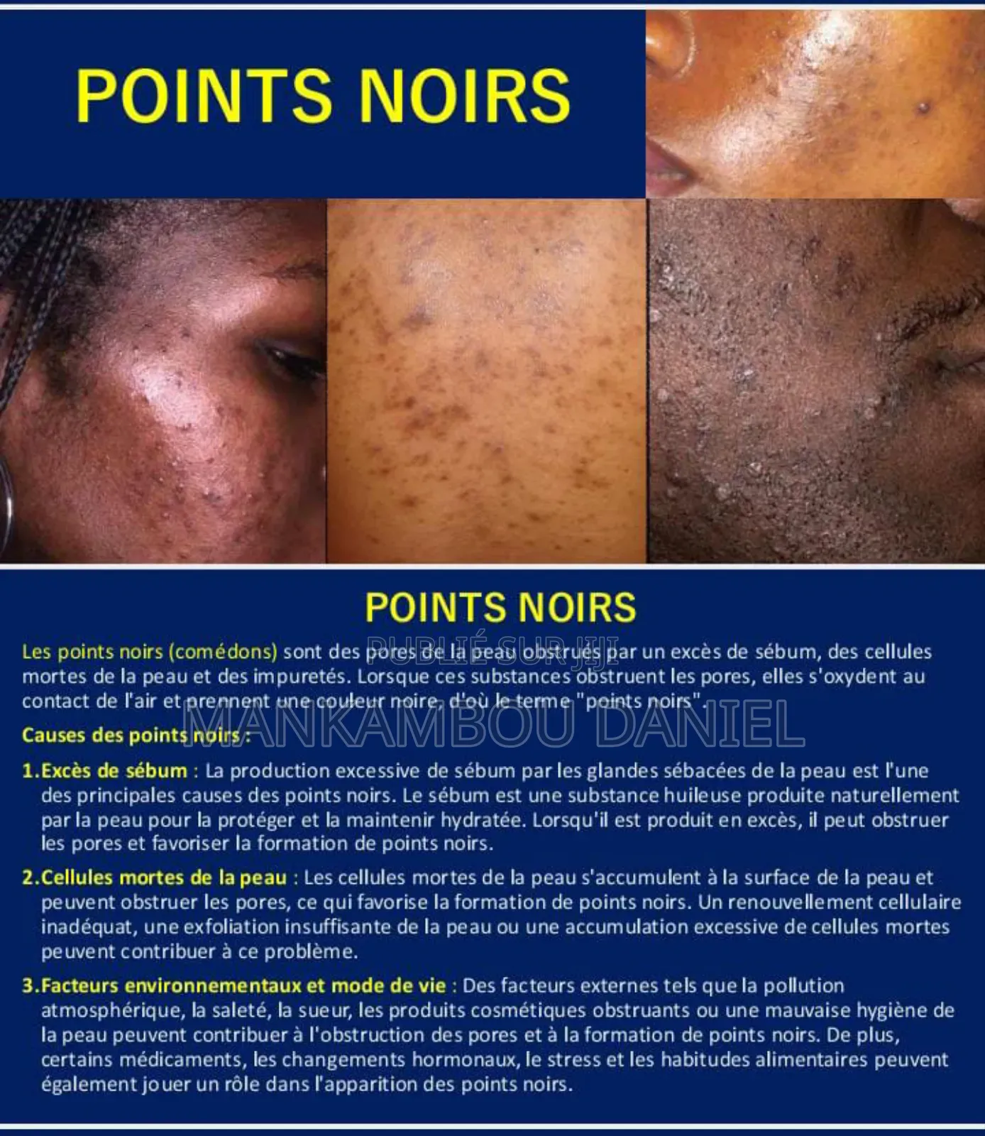 Savon Noir De Royal Cosmetik