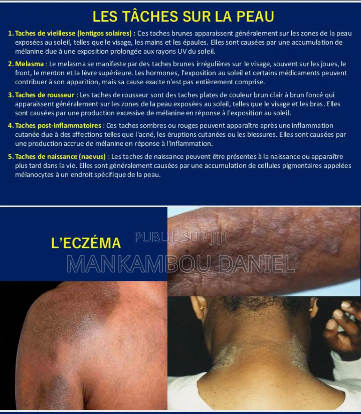 Savon Noir De Royal Cosmetik