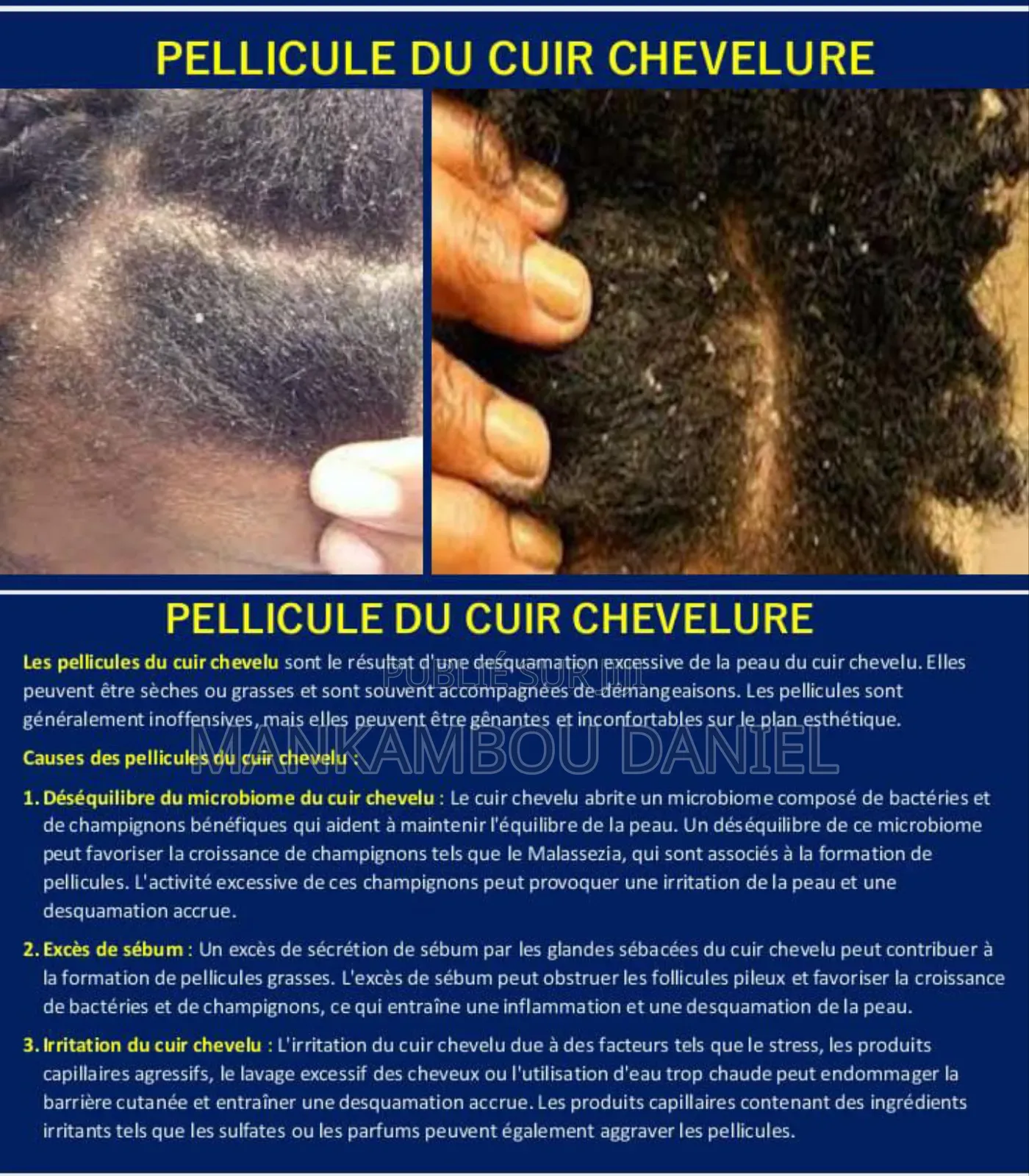 Savon Noir De Royal Cosmetik