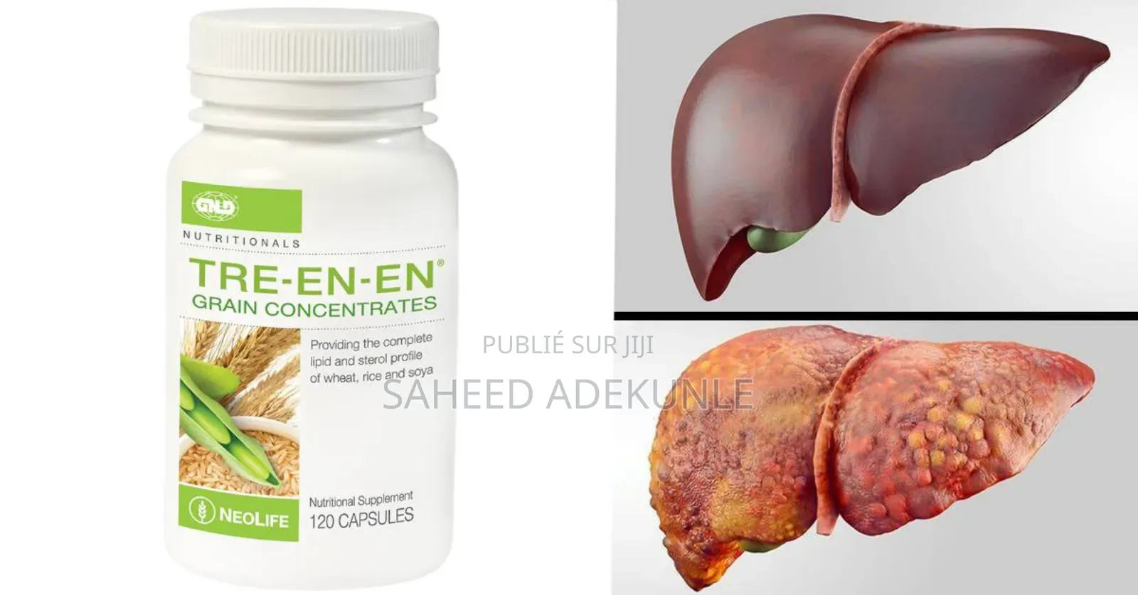 Tre-en-en (Les Céréales Complexe)