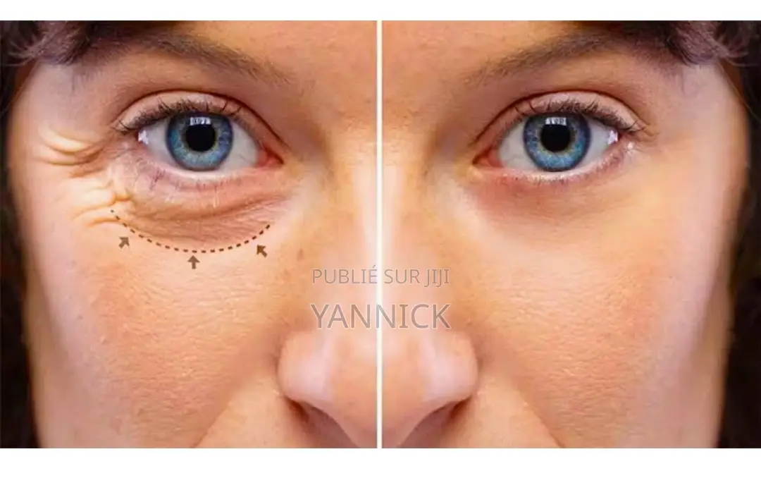 Vitamine C, Capsules Éclaircissantes