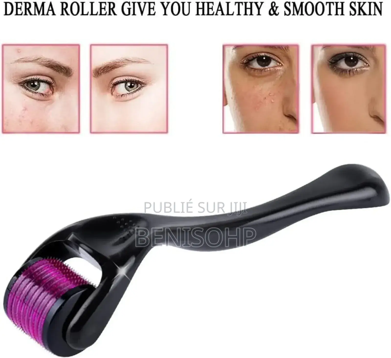 Derma Roller
