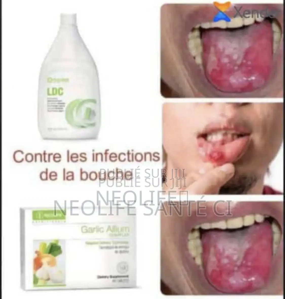 Lutte Contre Les Infections De La Bouche