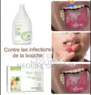 Photo - Lutte Contre Les Infections De La Bouche