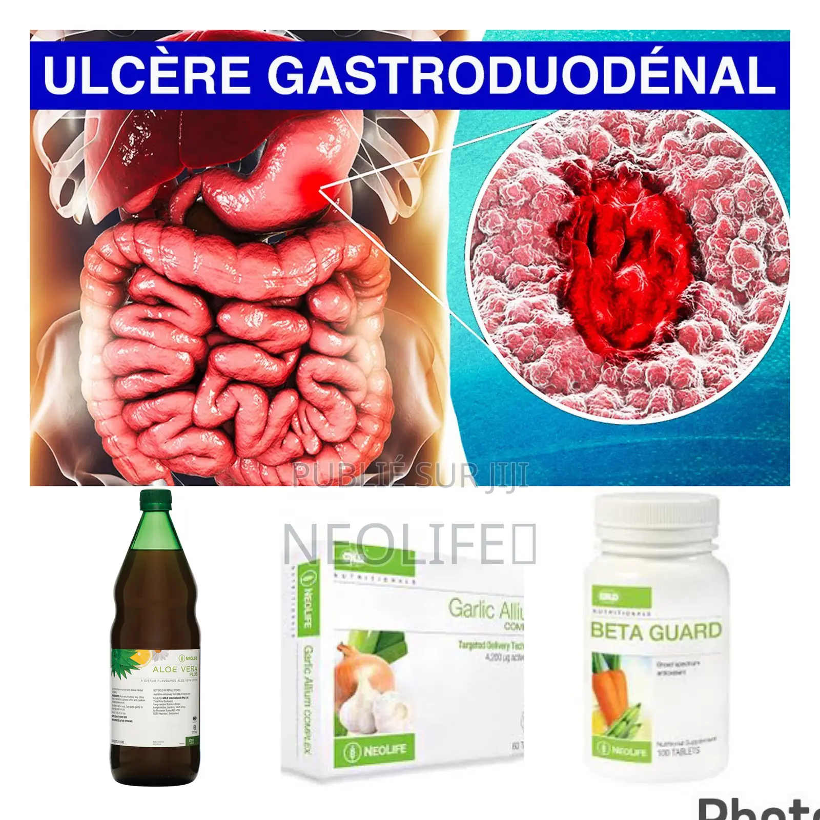 Traitement De L’Ulcère Gastroduodénal