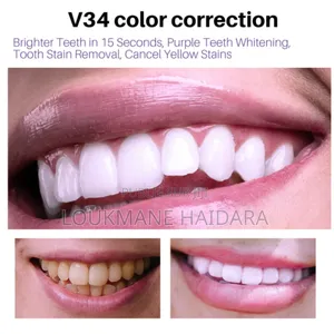 V34 Teeth Whitening Mousse