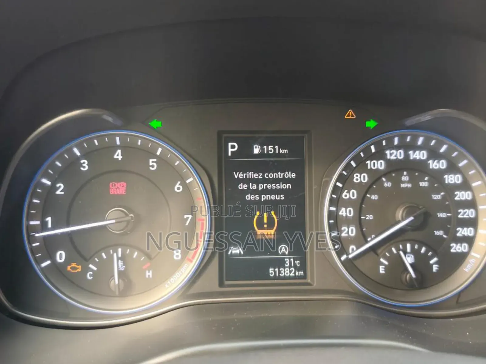 Hyundai Kona 2022 Blanc