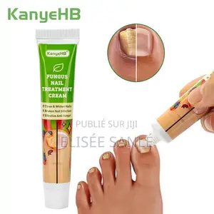 Crème Antifongique Pour Les Ongles Des Pieds