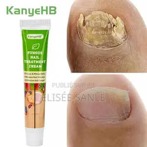 Crème Antifongique Pour Les Ongles Des Pieds