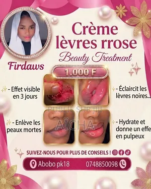 Lèvres Rose