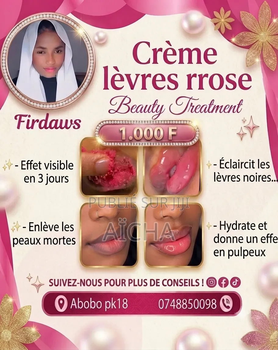 Lèvres Rose