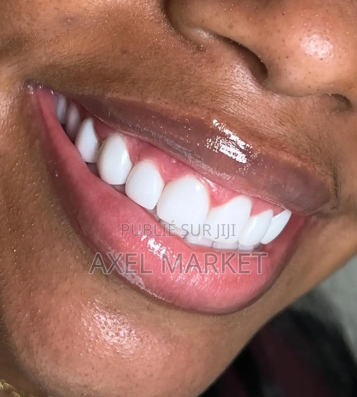 Tu Veux Des Dents Bien Blanches Contact Moi