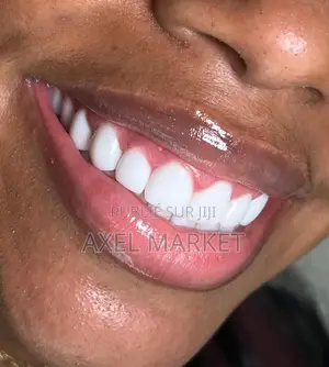 Tu Veux Des Dents Bien Blanches Contact Moi