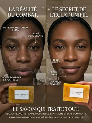 Savon Au Curcuma