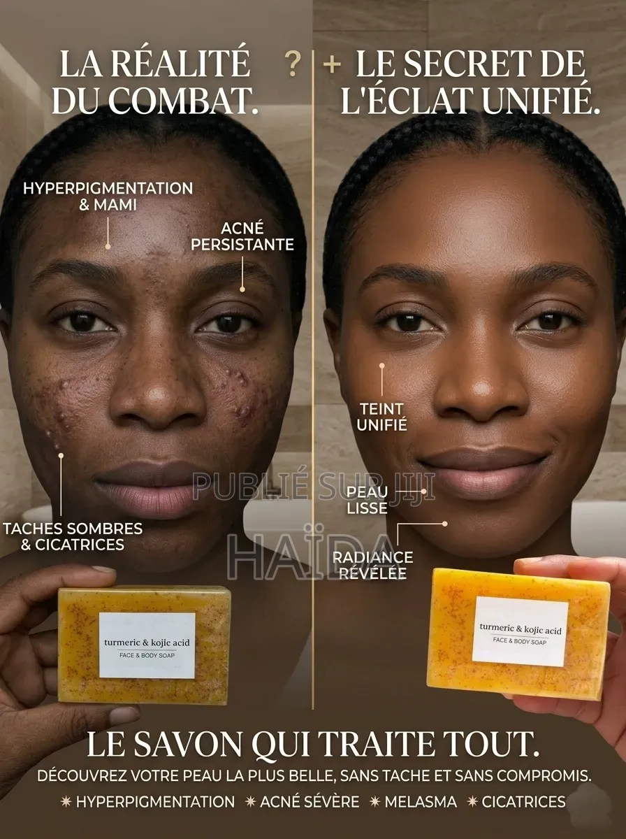 Savon Au Curcuma